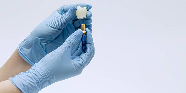Dental Implant